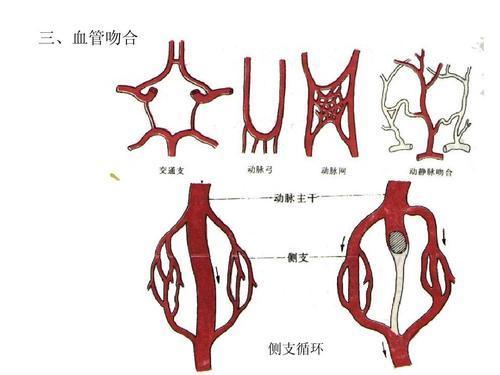 冠状动脉堵了怎么办 听说 心脏能 自我搭桥 关键要用对方法