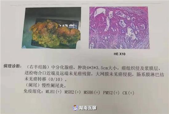 怎么补也补不上来的贫血 原来与癌细胞有关 出现这些症状要警惕