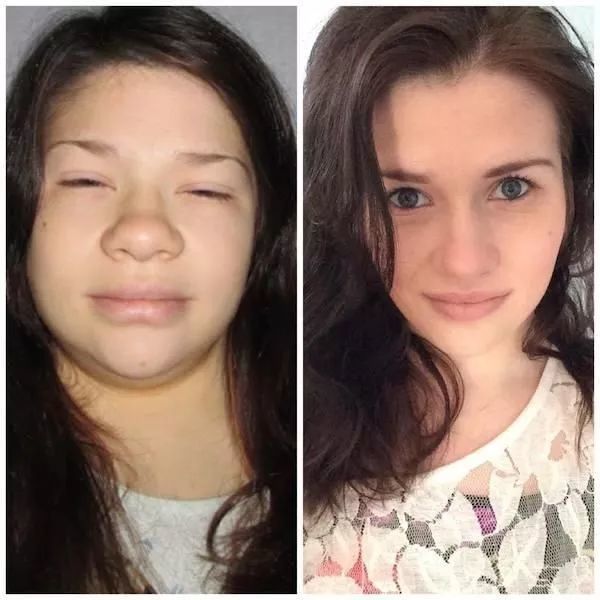 怕冷虚胖爱犯困可能是身体的这个器官在向你求救