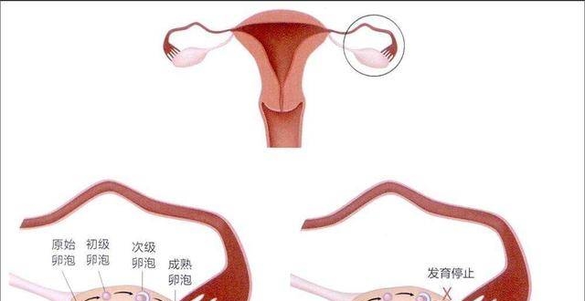 女性的多囊卵巢症状,会出现哪些特点呢?