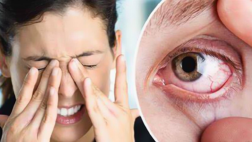 眼睛干涩疲劳是什么原因引起的?