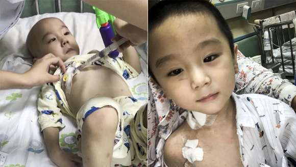 4���ȱ�����֢��������һ�仰��Ʋ���ϵ����ĸ�ף���������̫����