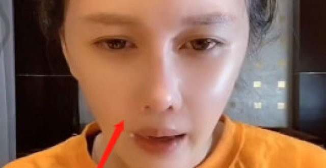 赵本山女儿直播撞脸李小璐，鼻子与以往不太一样，曾自曝价值30万