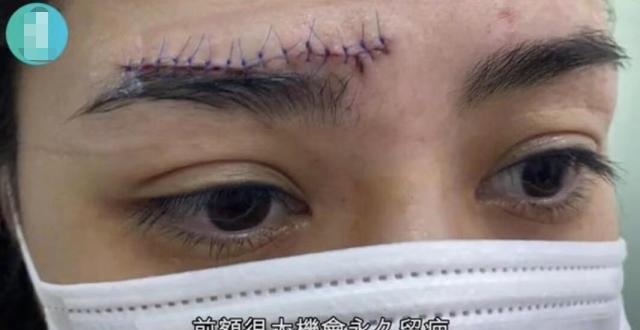 阿娇为减肥与好友现身医疗中心，每周定制素食餐单花费上万元