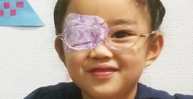 先天性弱视 300度散光 3年后会变成什么样子