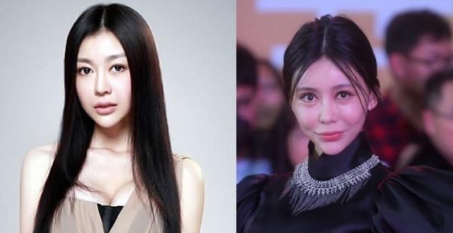 知名女星整容失败!看众多女星失败案例