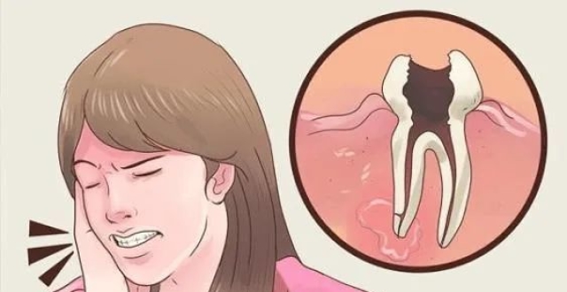 牙髓炎可以自愈吗?