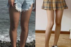 救命啊，体重100怎么样才能瘦腿啊？
