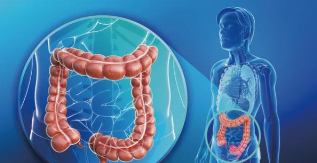 肠道健康的人,身体往往没有六种表现,养护肠道,记住四个字!