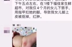 下手真狠！厦门大妈逛超市抠掉女婴脚皮，警方：已被拘留