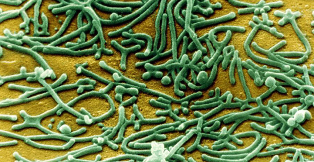 米高梅科学家谈细胞支原体(上)