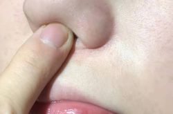 推荐几款好一点的去黑头产品？