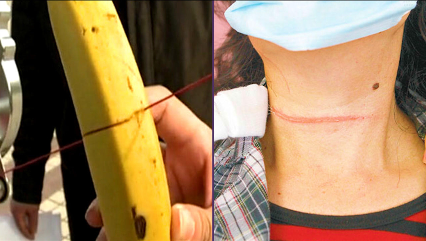 妇女骑车祸从天降,一只风筝的线正好勒住女子脖子,导致昏迷险丢命