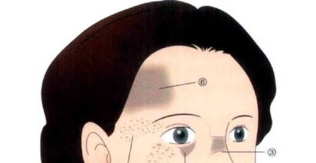 如何通过面部反应症状,快速辨别身体存在的问题.