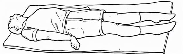 总之,去皮质僵直的姿态和木乃伊很像,因此也叫 mummy baby(木乃伊宝宝