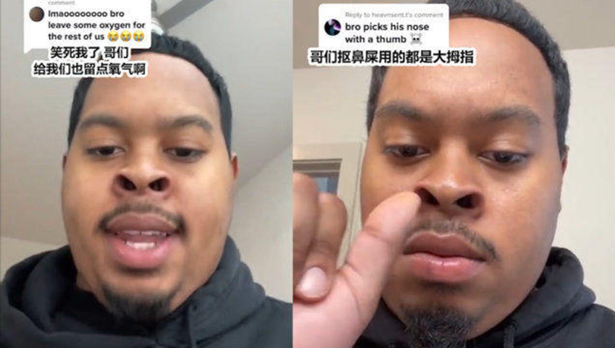 笑不活了!黑人小哥因鼻孔特大走红惹爆笑,网友:给我们留点氧气