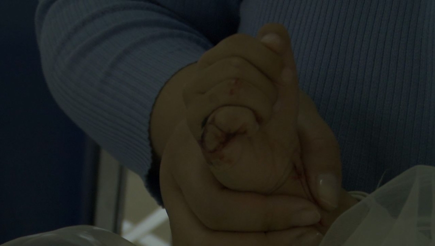 幼童手腕割伤血流不止 民警跨区护送