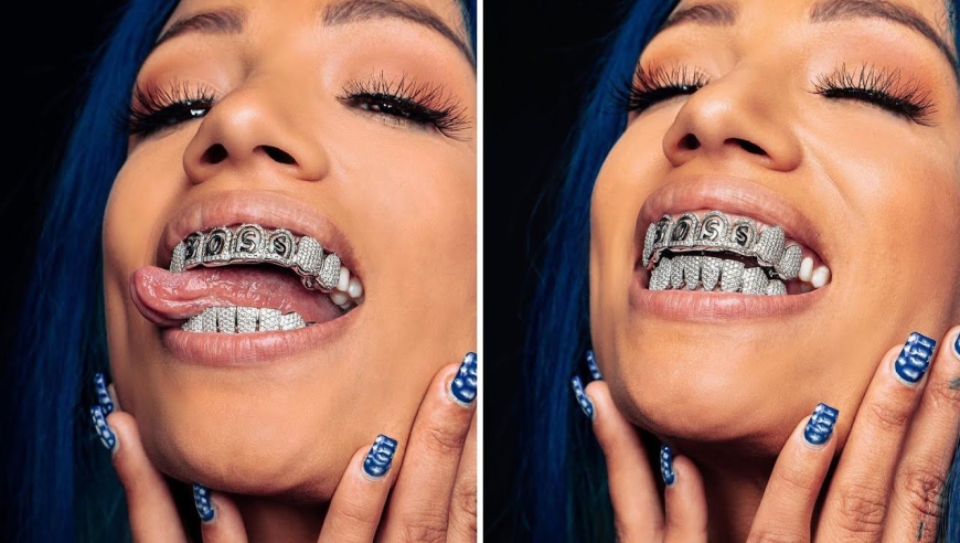 谢谢文斯!女王莎夏班克斯大秀她的炫酷钻石牙套