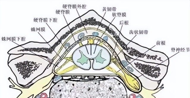 颈椎核磁报告单上写着"硬膜囊受压"表示脊髓,神经根受压了吗?