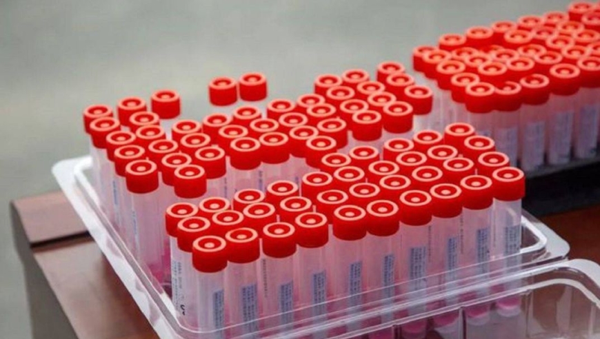 10个人做试管几个能成功(cccede)(10个人做试管几个能成功胳膊上面一根很明显的筋)-第2张图片-鲸幼网