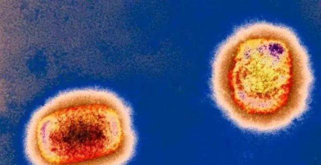 猴痘病毒疫情已出现人际传播，八问猴痘病毒疫情