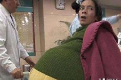 广东女子怀孕挺55公斤巨肚，12个月未见生产，医生直言看不见胎儿