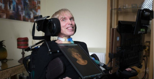 世界上第一个真正的赛博格宣告死亡,与渐冻症斗争5年