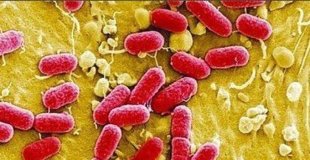 新生儿致死性感染：肠黏附性致泻大肠埃希氏菌（EAEC）_腾讯新闻