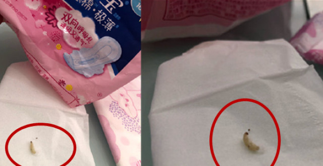 津网友买卫生巾 里面爬出虫子