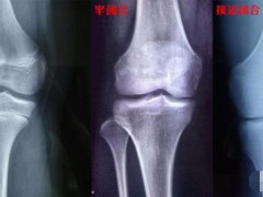 男孩子过了18岁还能再长高吗?