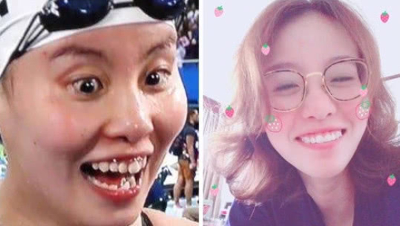 傅园慧拆了牙套削成瓜子脸 网友直呼超正!我恋