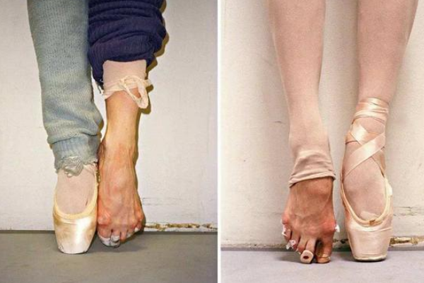 华为广告的这双芭蕾脚引起了多少家长的恐慌