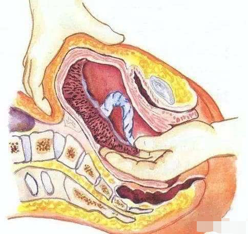分娩过程中如何才能让产妇加快分娩速度?这几个方法你要知道