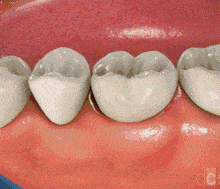 牙齿都去哪儿了? 原来这才是牙齿缺失的原因