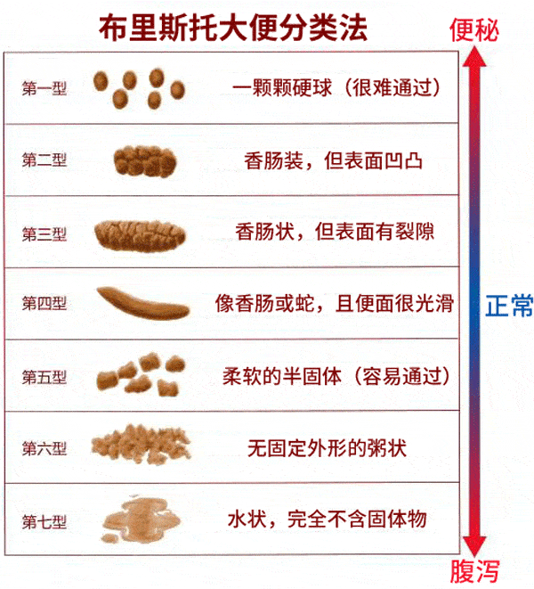 大便不成形一定是肠癌吗 别慌 医生告诉你怎么办 腾讯新闻