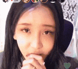 鼻唇沟纹怎么去除,去除鼻唇沟皱纹