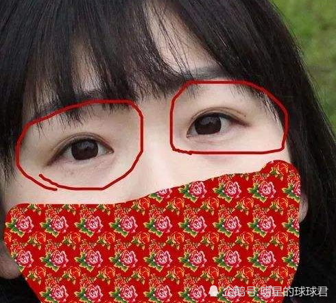 世界上最"神奇"的怪病,透视眼真的存在,最后一种女生都梦寐以求