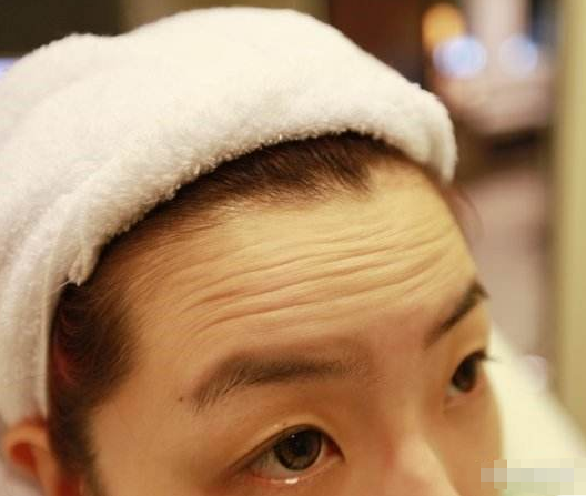 对抗脸上的"抬头纹",你仅需要做好3件事!