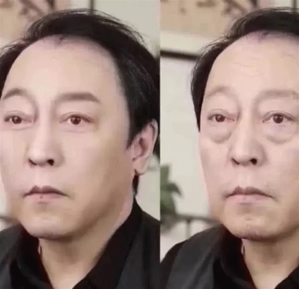 有种整容叫《都挺好》中的苏大强,如今去掉眼袋重回年轻,撞脸吴彦祖