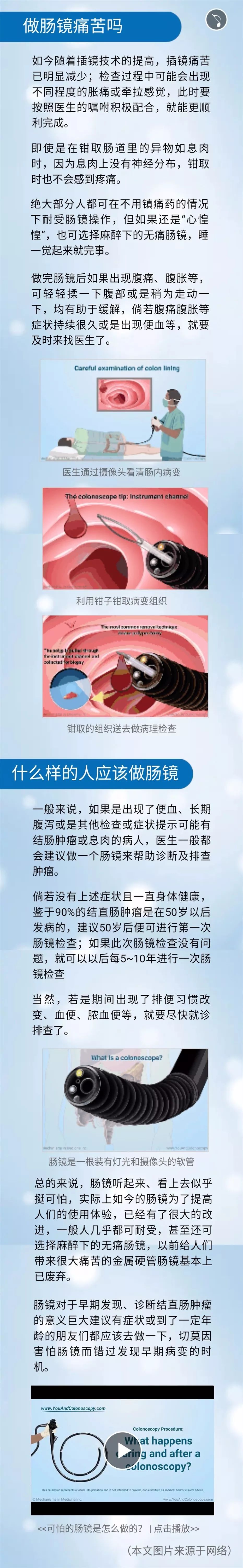 可怕的肠镜到底是怎么做的