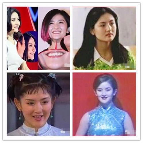 明星否认整容有高招，范爷ab做鉴定，不如谢娜一条微博有说服力