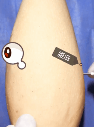 先进行腰麻与消毒第一步,与给人做手术的过程一样比如,用鼓着肚皮的