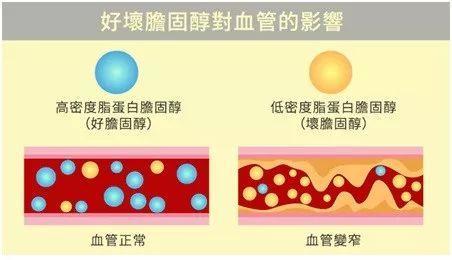 少吃蛋就能降胆固醇?戒掉"这食物"才有效