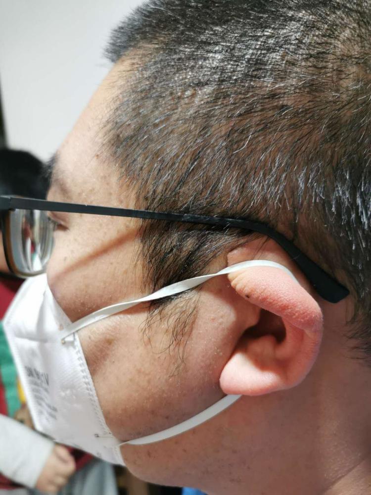 戴上口罩耳朵就折叠,专家支招来了