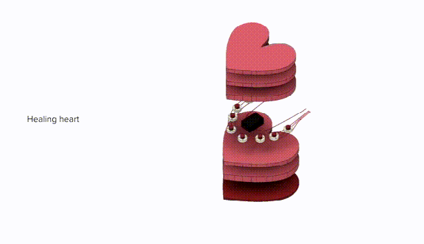 人们常常说,破碎的心无法愈合.