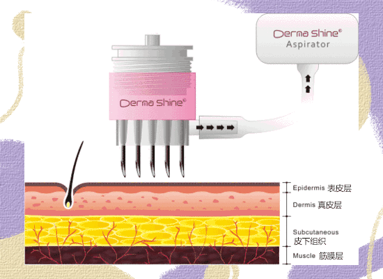 你想要了解的油痘肌医美项目都在这里了