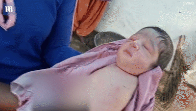 印度现 海豹娃娃 女婴出生就没有四肢 医生称实属 罕见 腾讯网