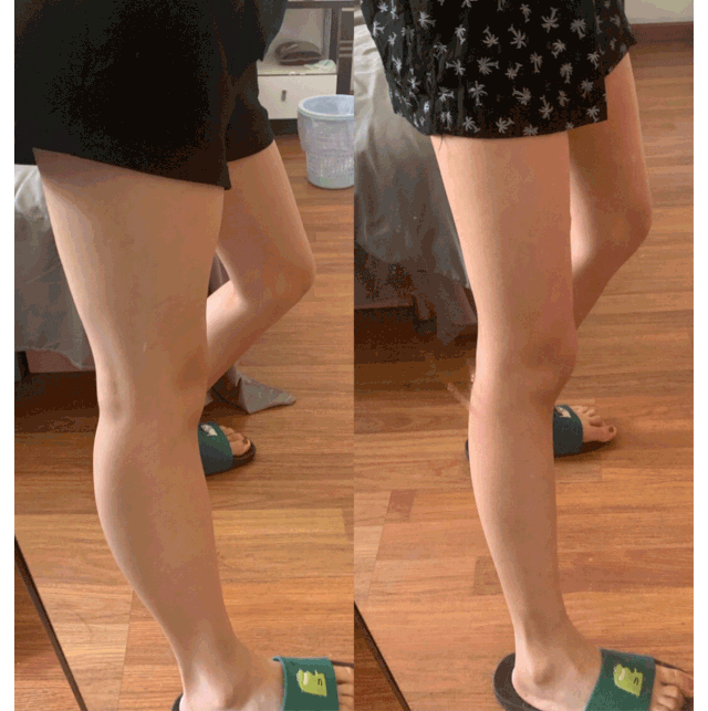 曾被笑小粗腿吴昕变美后人生果然能开挂!