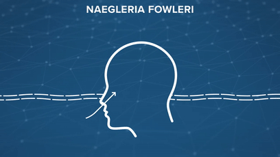 食脑虫|“食脑虫”再现美国，致死率高达97％，但这还不是最可怕的