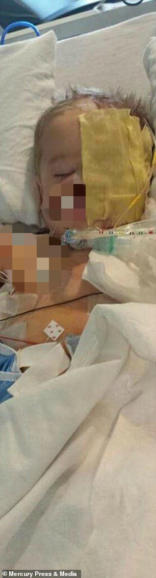 瑞德|美7岁男童遭2只恶犬疯狂撕咬丧失脸颊，做50次手术仍被骂怪物